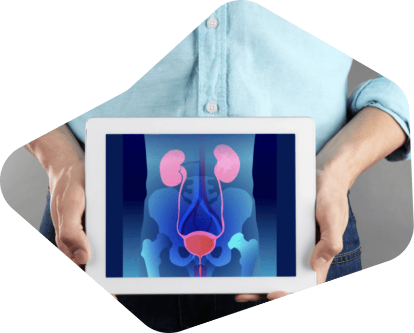 Reimplante ureteral en Mérida